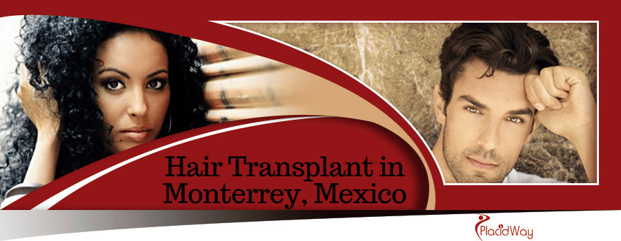 Hair Transplant in Monterrey Mexico